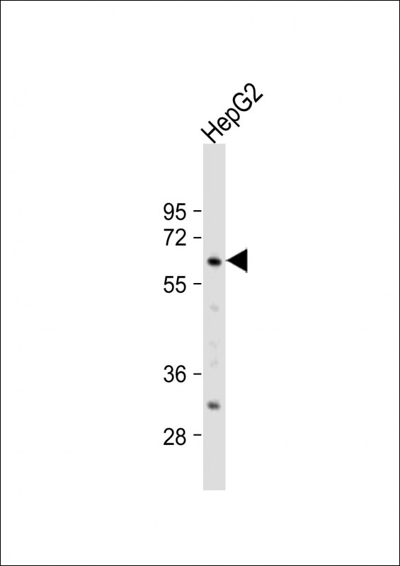 WB - Glypican 3 (GPC3) Antibody (N-term) AP6337a